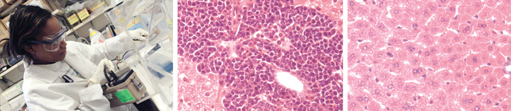 LOS-breastcancercells